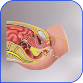 Pelvic abscess/collection drainage