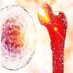 Pelvic Congestion Syndrome Treatment