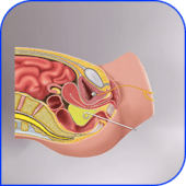 Pelvic abscess/collection drainage