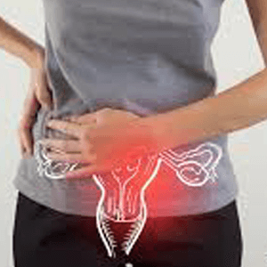 Pelvic Congestion Syndrome Treatment