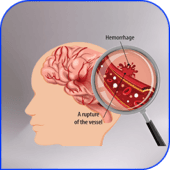 Tumor-related
hemorrhage